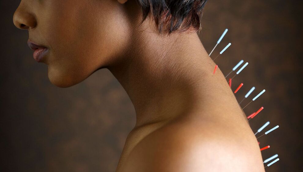 bachadon bo'yli osteokondroz bilan akupunktur