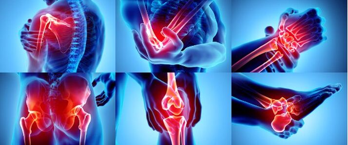 Yallig'langan bo'g'inlar